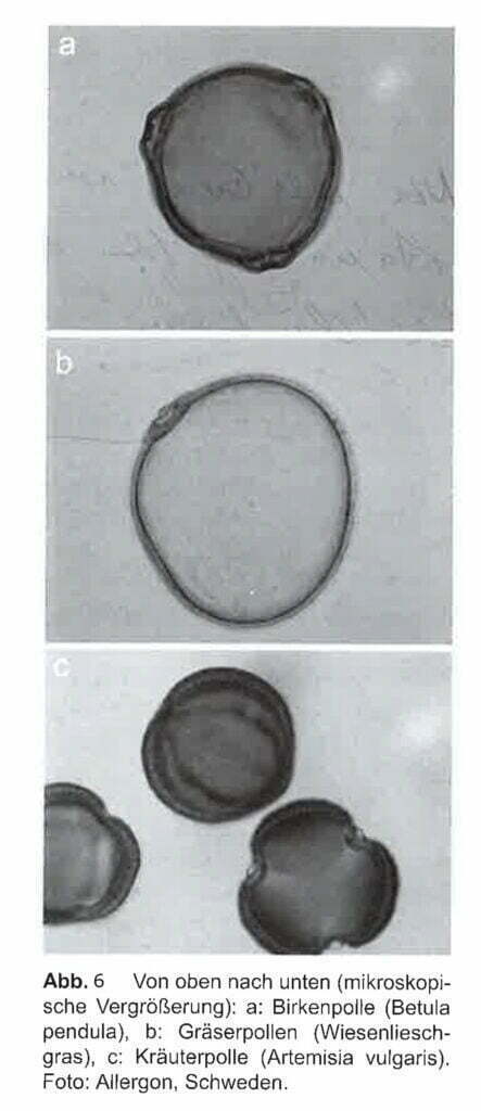 Bild zeigt mikroskopische Vergrößerung von Birkenpollen, Gräserpollen, Kräuterpollen.