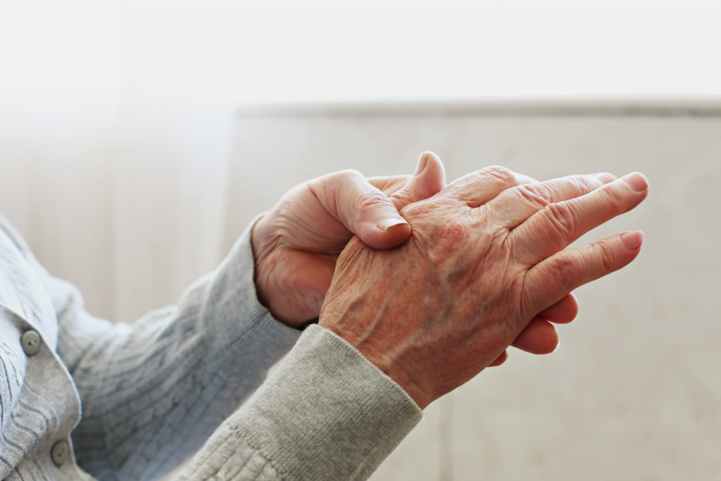 Hände einer älteren Person bei Neurodermitis im Alter