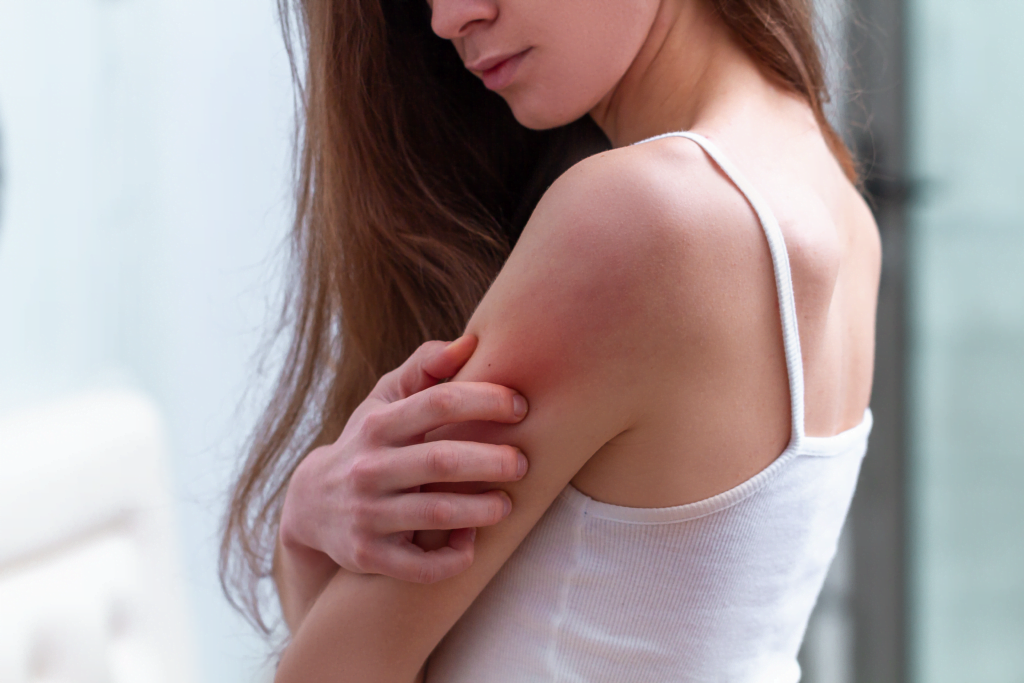 Juckende Haut, junge Frau kratzt sich am Arm