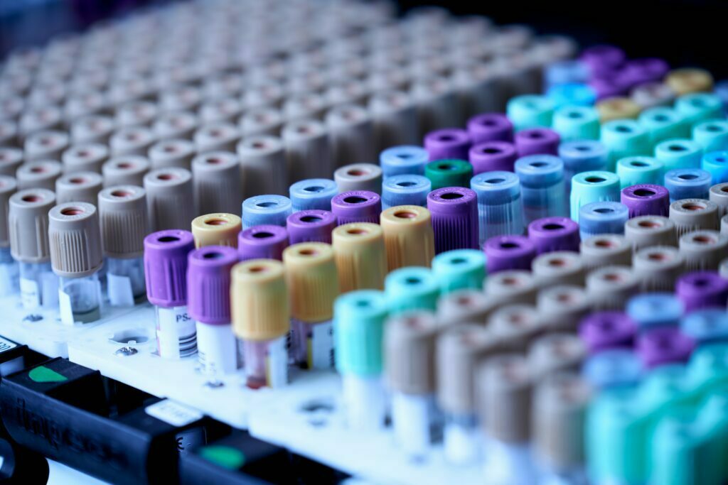 Bild zeigt Teströhrchen zur Bestimmung von Medikamentenallergie